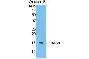 Western Blotting (WB) image for anti-Solute Carrier Family 30 (Zinc Transporter), Member 8 (SLC30A8) (AA 263-369) antibody (ABIN1176292) (SLC30A8 antibody  (AA 263-369))
