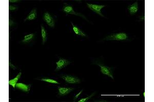Immunofluorescence of purified MaxPab antibody to CSDA on HeLa cell. (CSDA antibody  (AA 1-372))
