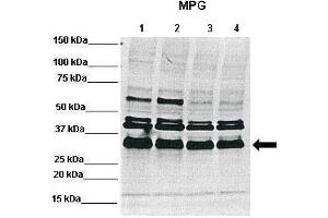 WB Suggested Anti-MPG Antibody    Positive Control:  Lane1: 50ug RCC4 lysate, Lane2: 50ug RCC4 lysate, Lane3: 50ug 786-0 lysate, Lane4: 50ug 786-0 lysate  Primary Antibody Dilution :   1:1000  Secondary Antibody :   Anti-rabbit-Alexa 680   Secondry Antibody Dilution :   1:5000  Submitted by:  Dr Ester Hammond, Gray Institute for Radiation Oncology and Biology-Department of Oncology, University of Oxford (MPG antibody  (C-Term))