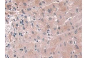 DAB staining on IHC-P; Samples: Human Liver Tissue (USP6NL antibody  (AA 1-292))