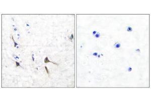 Immunohistochemistry (IHC) image for anti-Kv3.2b Potassium Channel (C-Term) antibody (ABIN1848746) (Kv3.2b Potassium Channel antibody  (C-Term))