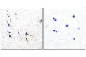 Immunohistochemistry (IHC) image for anti-Kv3.2b Potassium Channel (C-Term) antibody (ABIN1848746)