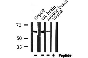 Western blot analysis of extracts from HepG2,rat brain,mouse brain, using CDKAL Antibody. (CDKAL1 antibody  (N-Term))