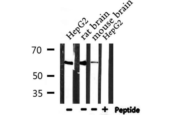 CDKAL1 antibody  (N-Term)