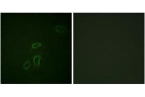 Immunofluorescence analysis of HepG2 cells, using CD171/N-CAML1 (Ab-1181) Antibody. (L1CAM antibody  (AA 1147-1196))