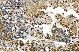 IHC analysis of HDAC4 using anti-HDAC4 antibody (ABIN5518841).