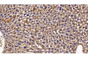 Immunohistochemistry (IHC) image for anti-Nuclear Factor-kB p65 (NFkBP65) (AA 19-306) antibody (ABIN7432211)