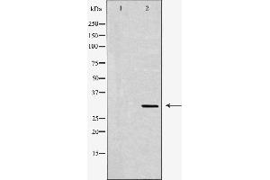 Western blot analysis of Hela whole cell lysates, using VDAC1  Antibody.