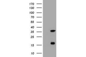 Image no. 5 for anti-Thymidylate Synthetase (TYMS) antibody (ABIN1501589) (TYMS antibody)