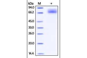Cynomolgus PD-L1, Fc Tag on SDS-PAGE under reducing (R) condition. (PD-L1 Protein (AA 19-238) (Fc Tag))