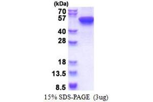 SDS-PAGE (SDS) image for Keratin 16 (KRT16) (AA 1-473) protein (His tag) (ABIN5853597) (KRT16 Protein (AA 1-473) (His tag))