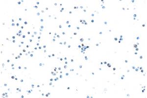 Immunocytochemistry (ICC) image for anti-Spleen Focus Forming Virus (SFFV) Proviral Integration Oncogene Spi1 (SPI1) (AA 220-270) antibody (ABIN7455166)