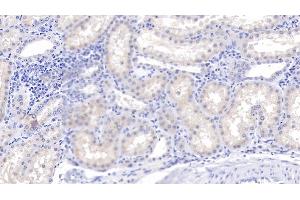 Detection of C1qB in Human Kidney Tissue using Polyclonal Antibody to Complement Component 1, Q Subcomponent B (C1qB) (C1QB antibody  (AA 28-253))