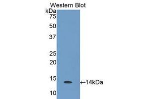 Western blot analysis of the recombinant protein. (CCL26 antibody  (AA 24-94))