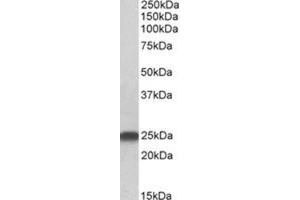 AP31418PU-N LIN7B antibody staining of Rat Brain lysate at 0. (LIN7B antibody  (N-Term))