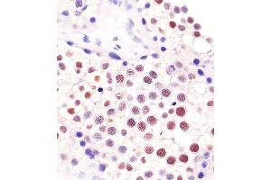 Immunohistochemistry (Paraffin-embedded Sections) (IHC (p)) image for anti-ELAV (Embryonic Lethal, Abnormal Vision, Drosophila)-Like 1 (Hu Antigen R) (ELAVL1) antibody (ABIN652911)