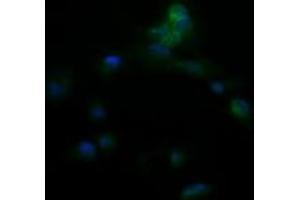 Image no. 2 for anti-Amyloid P Component, Serum (APCS) antibody (ABIN1500900) (APCS antibody)