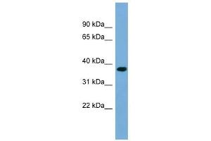 RPRD1B antibody used at 1 ug/ml to detect target protein. (RPRD1B antibody  (Middle Region))