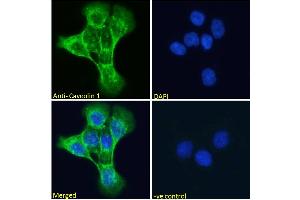 Immunofluorescence (IF) image for anti-Caveolin 1, Caveolae Protein, 22kDa (CAV1) (Internal Region) antibody (ABIN185421)