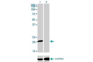 Western blot analysis of ATF3 over-expressed 293 cell line, cotransfected with ATF3 Validated Chimera RNAi (Lane 2) or non-transfected control (Lane 1). (ATF3 antibody  (AA 1-181))