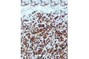 Immunohistochemistry (IHC) image for anti-Secretoglobin, Family 2A, Member 2 (SCGB2A2) antibody (ABIN452654) (Mammaglobin A antibody)