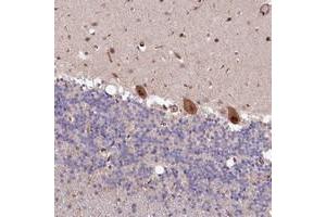 Immunohistochemical staining of human cerebellum with LSG1 polyclonal antibody  shows strong nuclear and cytoplasmic positivity in Purkinje cells at 1:200-1:500 dilution. (Lsg1 antibody)