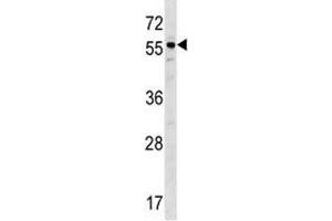 BMP3 antibody western blot analysis in ZR-75-1 lysate. (BMP3 antibody  (AA 318-347))