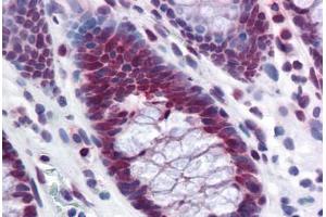 Human Colon: Formalin-Fixed, Paraffin-Embedded (FFPE) (RPL39L antibody  (AA 1-52))