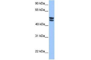 OXCT1 antibody used at 1 ug/ml to detect target protein.