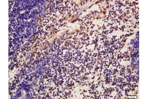 Formalin-fixed and paraffin embedded mouse spleen labeled with Anti-phospho-ATG16A(Ser287)Polyclonal Antibody, Unconjugated  at 1:200 followed by conjugation to the secondary antibody and DAB staining (ATG16L1 antibody  (pSer287))