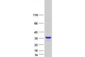 Validation with Western Blot (KCNRG Protein (Transcript Variant 2) (Myc-DYKDDDDK Tag))