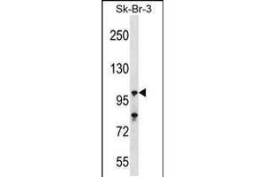 Western blot analysis in SK-BR-3 cell line lysates (35ug/lane). (USP16 antibody  (N-Term))