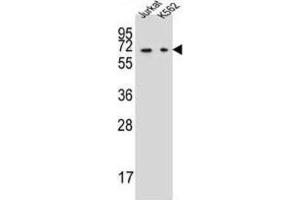 Western Blotting (WB) image for anti-Dihydropyrimidinase (DPYS) antibody (ABIN2997327) (DPYS antibody)