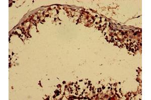 Immunohistochemistry analysis of human testis tissue using ABIN7153092 at dilution of 1:100 (FOXP1 antibody  (AA 541-677))