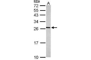 WB Image Sample (50 ug of whole cell lysate) A: mouse brain 12% SDS PAGE antibody diluted at 1:500 (rala antibody  (Center))