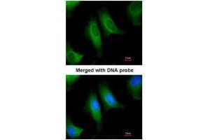 ICC/IF Image Immunofluorescence analysis of paraformaldehyde-fixed HeLa, using HACL1, antibody at 1:200 dilution. (HACL1 antibody  (C-Term))