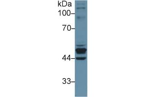 Western Blot; Sample: Human Placenta lysate; Primary Ab: 1µg/ml Rabbit Anti-Human KRT23 Antibody Second Ab: 0. (KRT23 antibody  (AA 243-382))