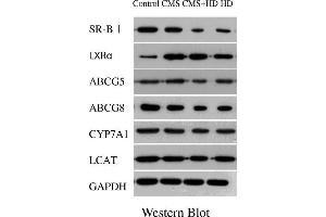 The results of qPCR showed that high fat diet (HD) significantly decreased the expression of LXRα, ABCG5, ABCG8, SR-BI, CYP7A1 and LCAT,and CMS alone significantly elevated the expression of LXRα, ABCG5, ABCG8, and SR-BI, while CMS + HD significantly decreased the expression of ABCG5, ABCG8, CYP7A1 and LCAT. (CYP7A1 antibody  (AA 351-400))