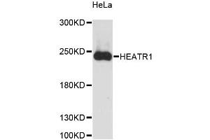 Western blot analysis of extracts of HeLa cells, using HEATR1 antibody (ABIN6290508) at 1:3000 dilution. (HEATR1 antibody)