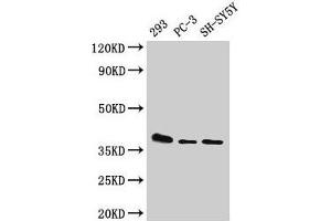 Western Blot Positive WB detected in: 293 whole cell lysate, PC-3 whole cell lysate, SH-SY5Y whole cell lysate All lanes: ELOVL4 antibody at 1:500 Secondary Goat polyclonal to rabbit IgG at 1/50000 dilution Predicted band size: 37 kDa Observed band size: 37 kDa
