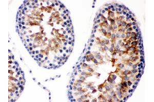 Smac/Diablo was detected in paraffin-embedded sections of rat testis tissues using rabbit anti- Smac/Diablo Antigen Affinity purified polyclonal antibody at 1 μg/mL.