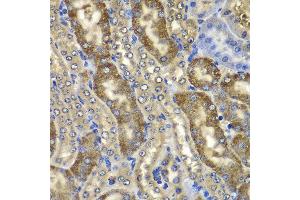 Immunohistochemistry of paraffin-embedded mouse kidney using NMT2 antibody at dilution of 1:100 (x400 lens). (NMT2 antibody)