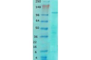 Western Blotting rat brain membrane GluN1NR1 1 in 1000. (GRIN1/NMDAR1 antibody  (AA 42-361))