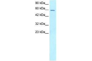 FOXG1A antibody used at 5-8 ug/ml to detect target protein. (FOXG1 antibody  (N-Term))