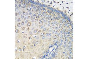 Immunohistochemistry of paraffin-embedded human esophagus using EEF1G antibody at dilution of 1:100 (40x lens).