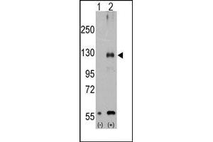Image no. 1 for anti-Transient Receptor Potential Cation Channel, Subfamily M, Member 8 (TRPM8) (Middle Region) antibody (ABIN360716) (TRPM8 antibody  (Middle Region))