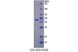 SDS-PAGE (SDS) image for Alanine Glyoxylate Aminotransferase (AGXT) (AA 187-741) protein (His tag) (ABIN6239476) (AGXT Protein (AA 187-741) (His tag))