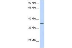 Image no. 1 for anti-V-Crk Sarcoma Virus CT10 Oncogene Homolog (Avian) (CRK) (AA 182-231) antibody (ABIN6748018) (Crk antibody  (AA 182-231))