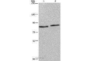 Western blot analysis of 293T and K562 cell, using ITGB2 Polyclonal Antibody at dilution of 1:600 (Integrin beta 2 antibody)
