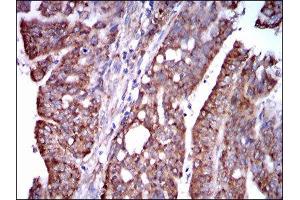 Immunohistochemistry (IHC) image for anti-Signal Transducer and Activator of Transcription 5A (STAT5A) (AA 583-794) antibody (ABIN1845625) (STAT5A antibody  (AA 583-794))